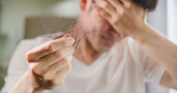 PRF Hair Loss Treatment